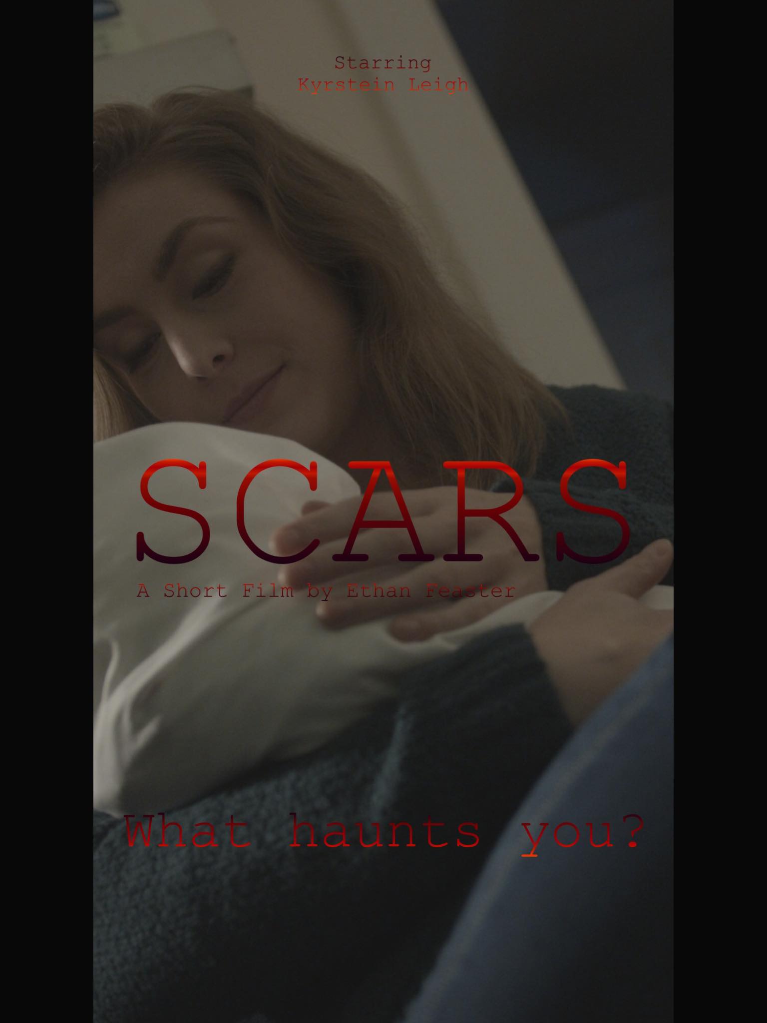 Scars